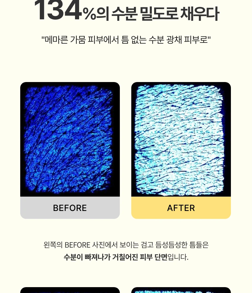 거친 피부 단면이 수분 광채로 가득 채워진 현미경 비교 샷으로 보는 비포 애프터입니다.